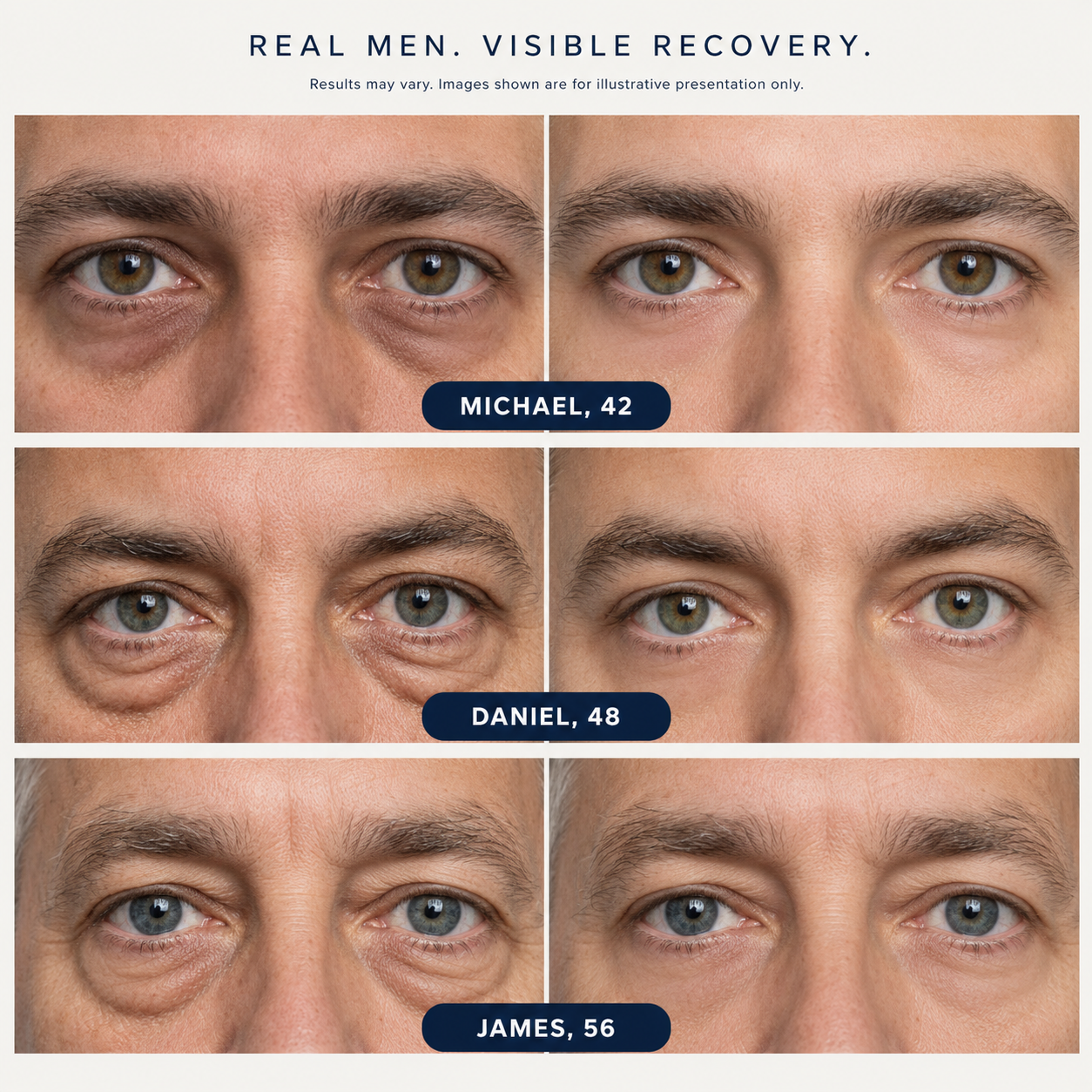 REVIVE before and after results for three men