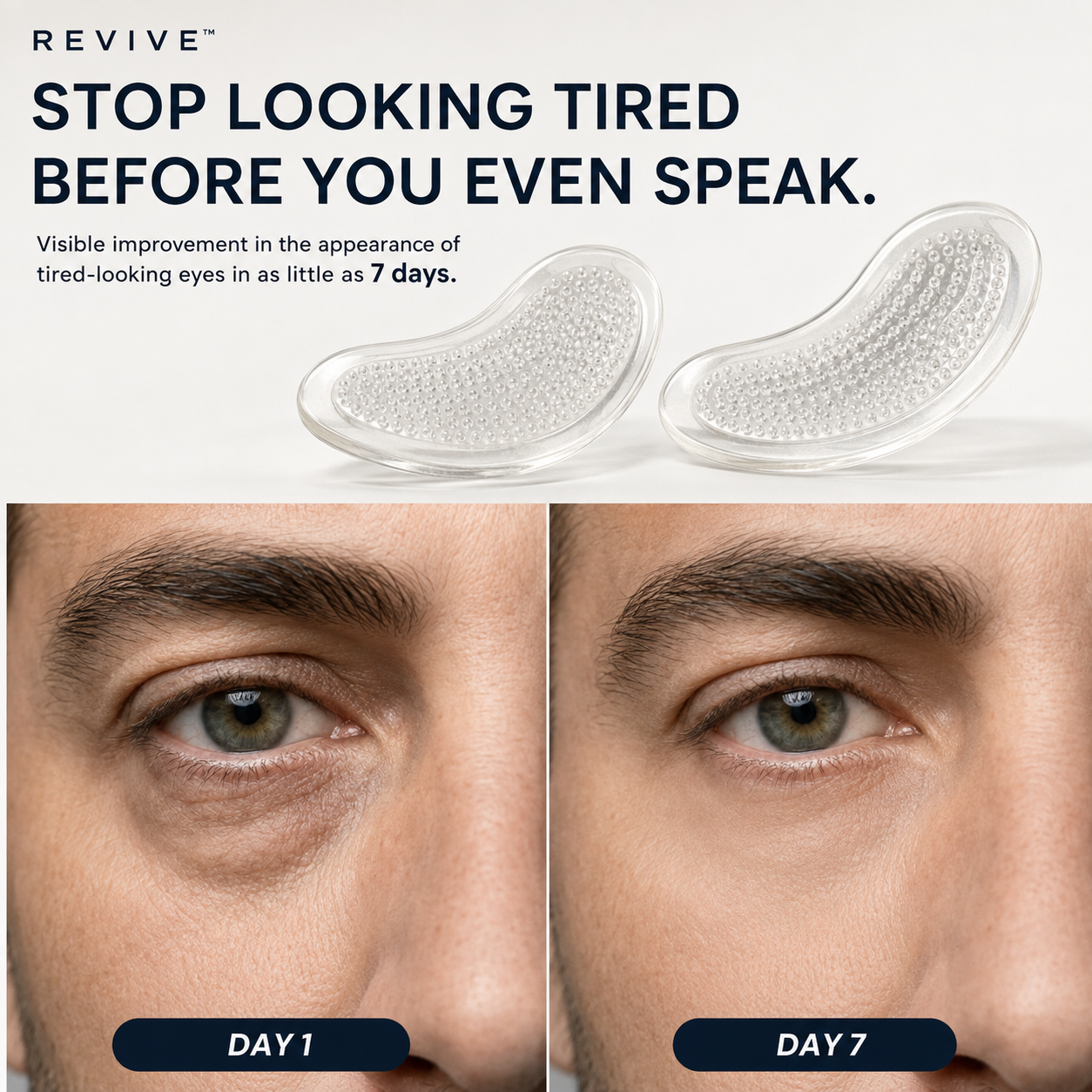 REVIVE Day 1 and Day 7 under-eye appearance comparison